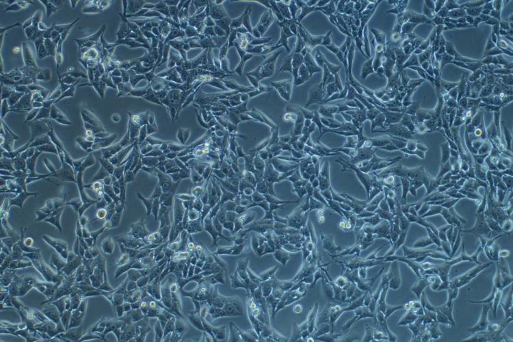 小鼠腎癌細胞Renca(種屬鑒定)