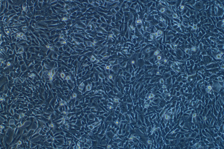小鼠肺上皮細胞TC-1(STR鑒定正確)