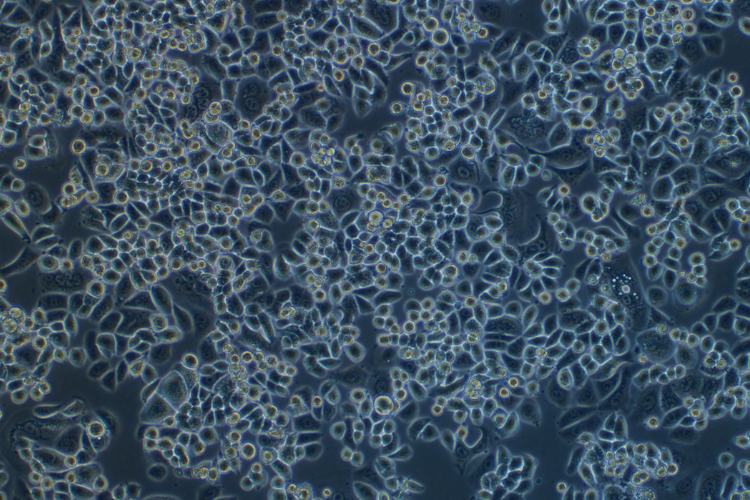 人乳腺癌細胞AU565(STR鑒定正確)