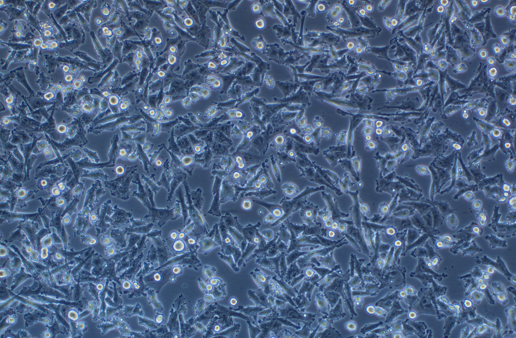 人肺泡細胞癌細胞 SW1573(STR鑒定正確)