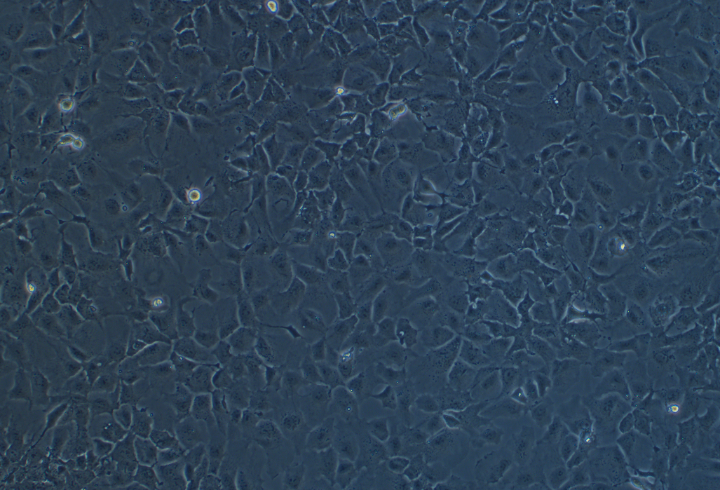 人肝癌細(xì)胞Hep3B(STR鑒定正確)