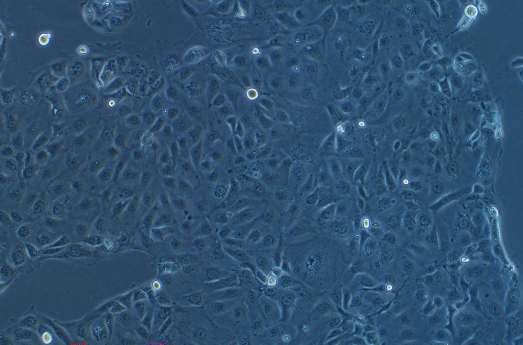 人非小細胞肺癌細胞NCI-H2347(STR鑒定正確)