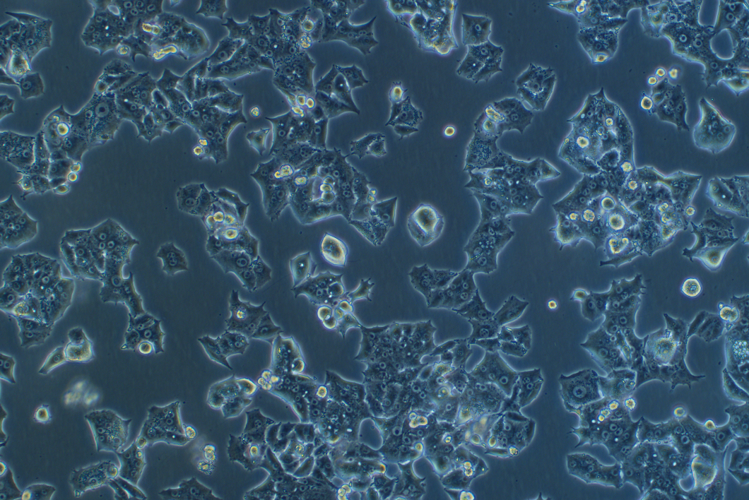 人非小細胞肺癌細胞NCI-H1395(STR鑒定正確)