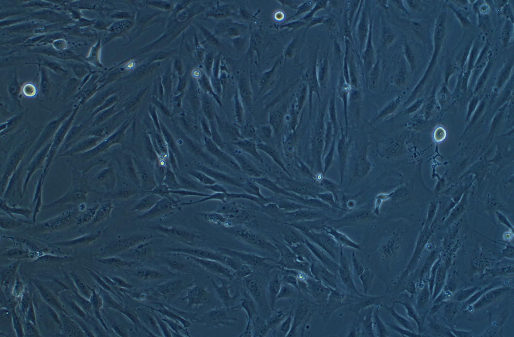 人子宮平滑肌細胞