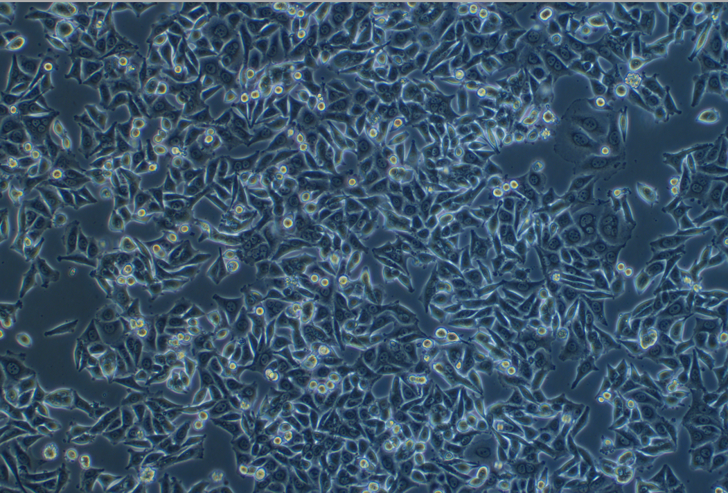 人胃癌細(xì)胞MKN-1