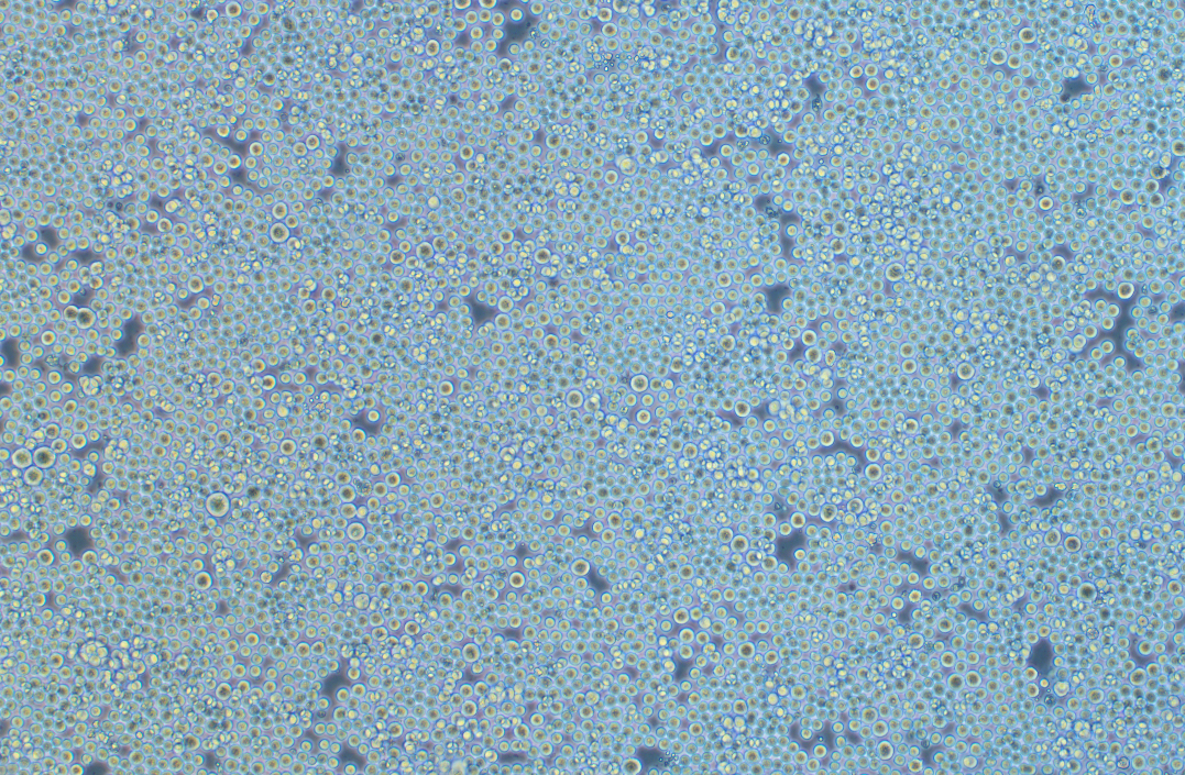 小鼠骨髓瘤細(xì)胞NS-1(種屬鑒定)