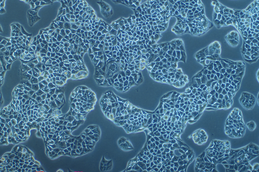 人細支氣管肺泡癌細胞NCI-H1781(STR鑒定正確)
