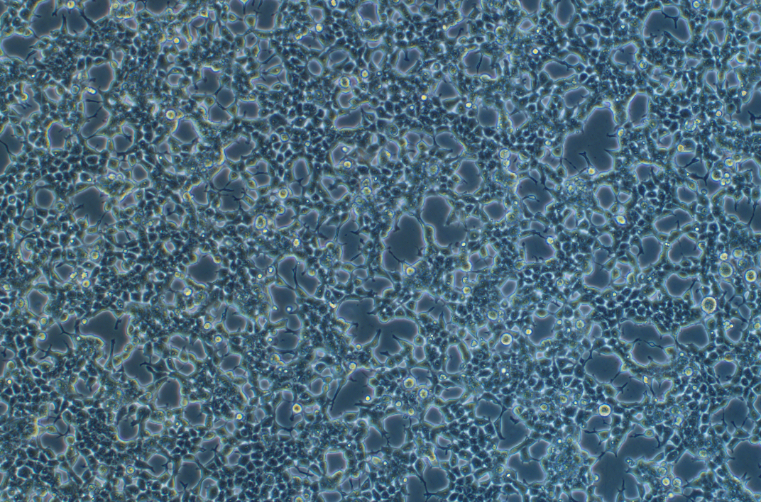 人逆轉(zhuǎn)錄病毒包裝細(xì)胞系Phoenix-ECO?(STR鑒定正確)