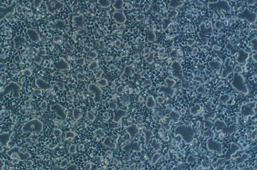 人逆轉(zhuǎn)錄病毒包裝細(xì)胞系Phoenix-ECO?(STR鑒定正確)