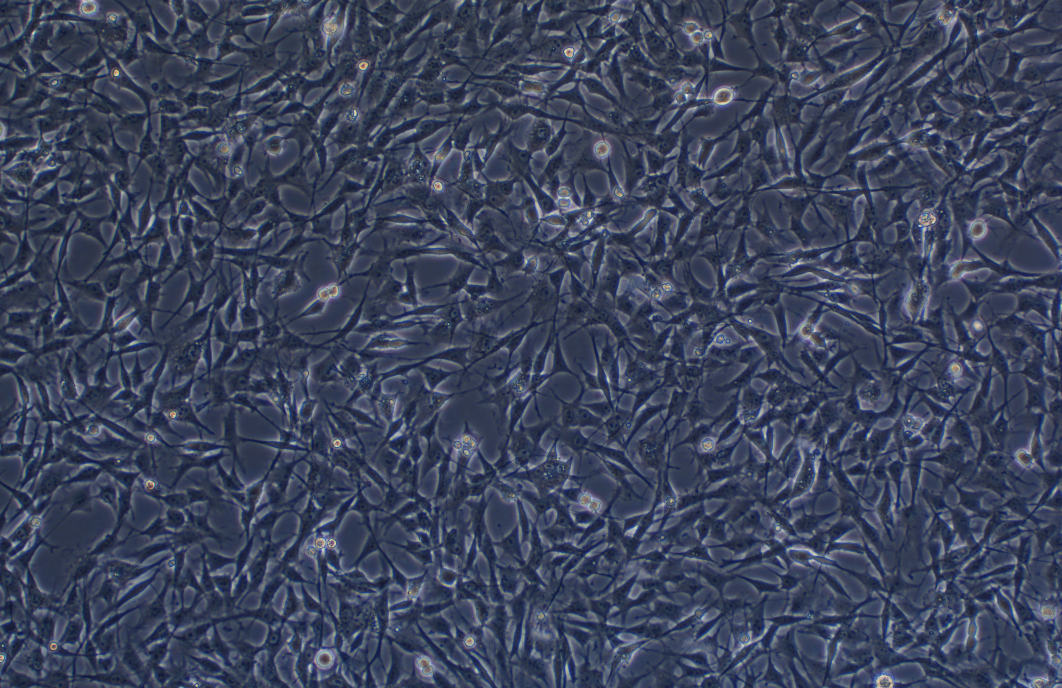 大鼠空腸膠質(zhì)細(xì)胞EGC CRL-2690(種屬鑒定)