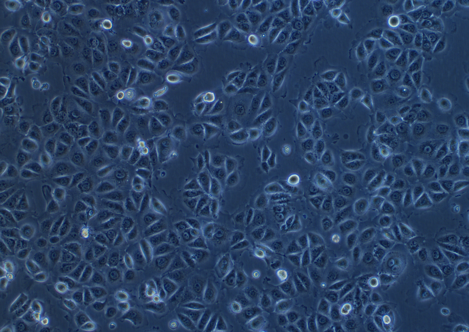 人正常結腸上皮細胞NCM-460(STR鑒定正確)