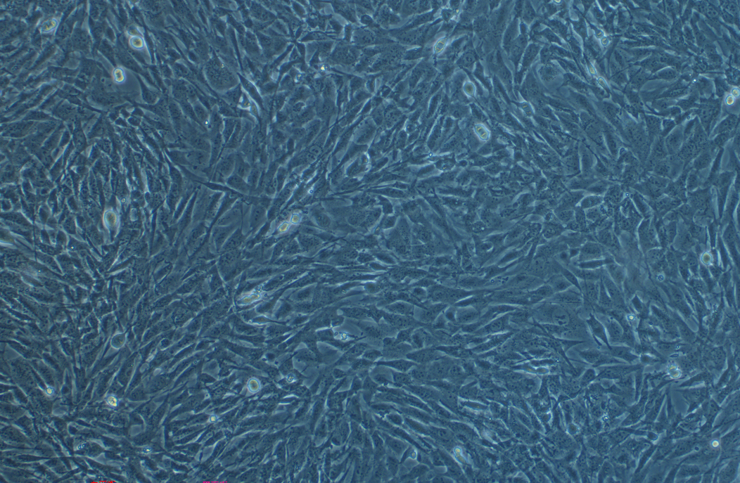 人骨肉瘤細胞SJSA-1 (STR鑒定正確)