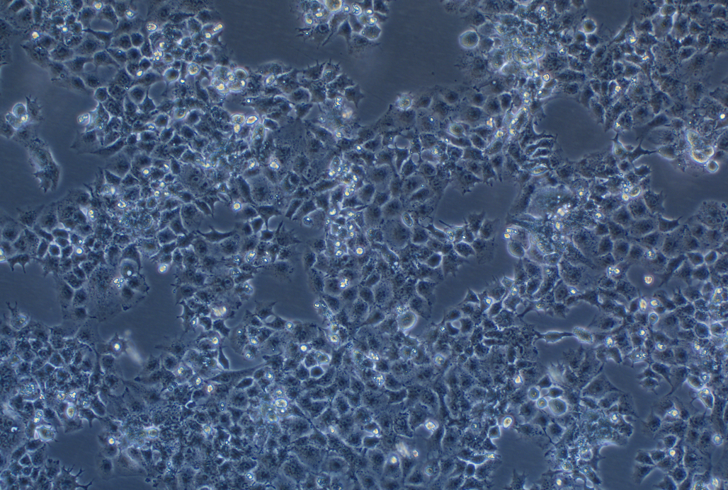 人胎盤絨毛癌細胞JAR(STR鑒定正確)
