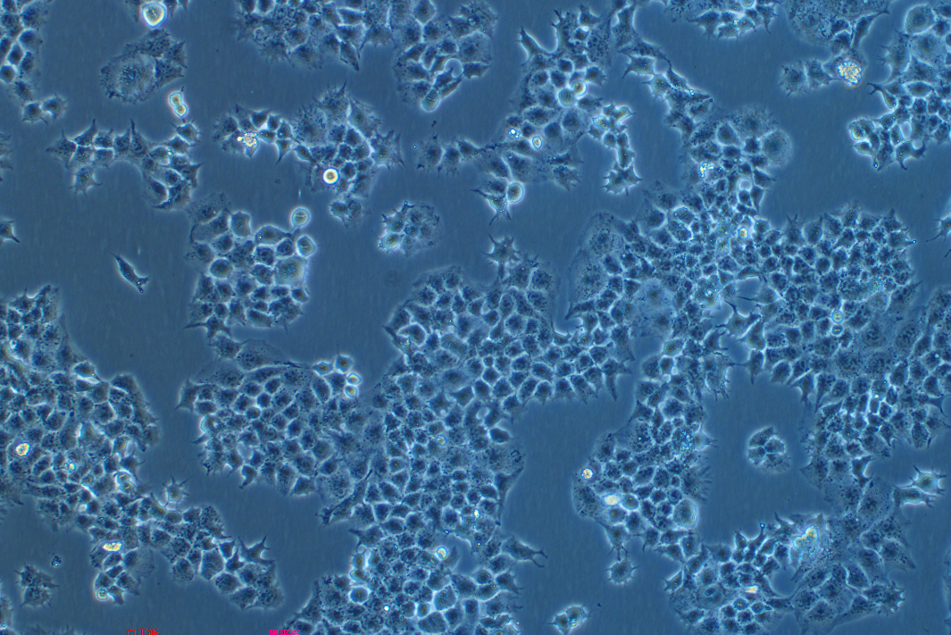 人胎盤絨毛癌細胞JAR(STR鑒定正確)