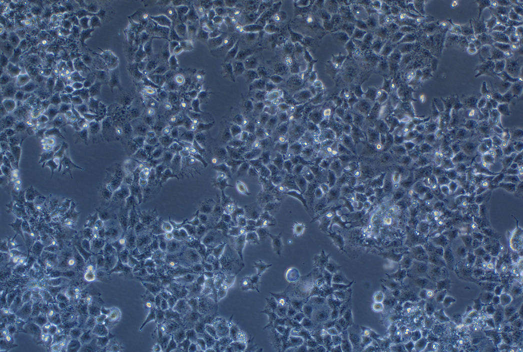 人胎盤絨毛癌細胞JAR(STR鑒定正確)