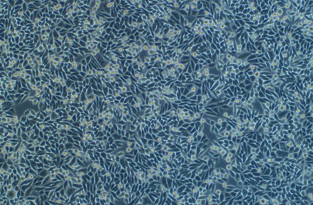 人結腸癌細胞SW480(STR鑒定正確)