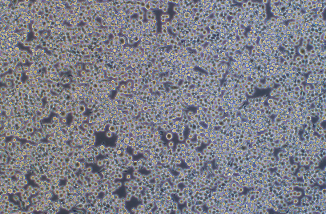 小鼠單核巨噬細胞J774A.1(種屬鑒定)