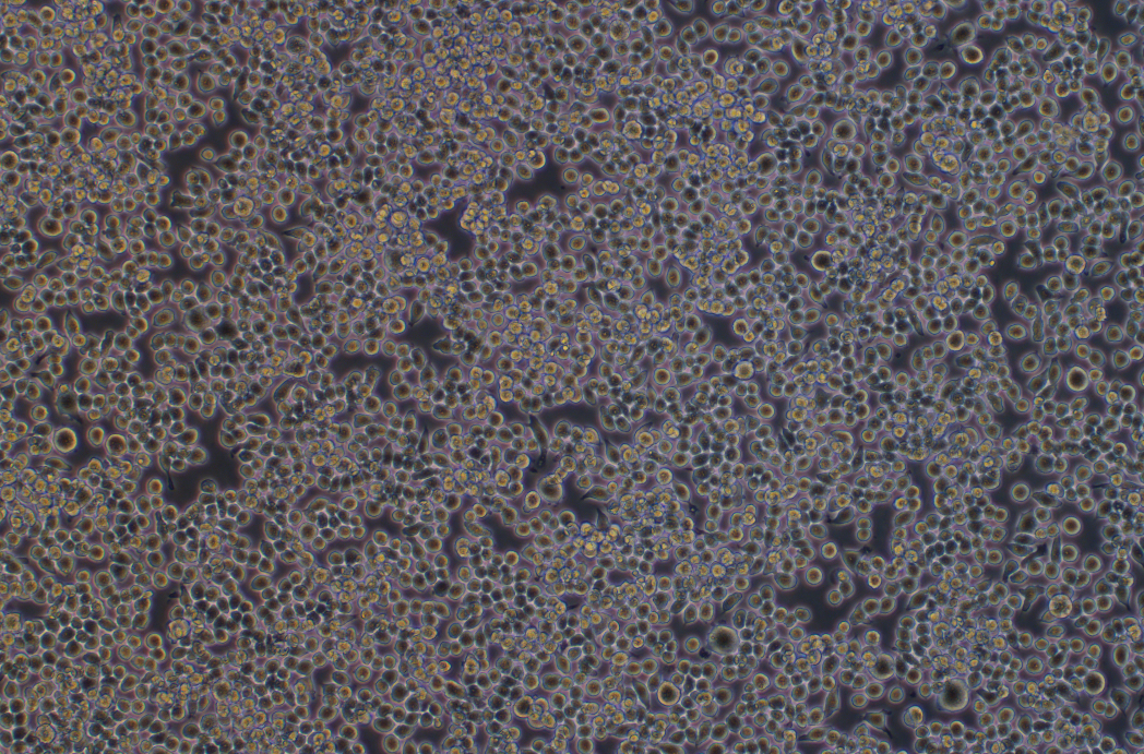 小鼠單核巨噬細胞J774A.1(種屬鑒定)