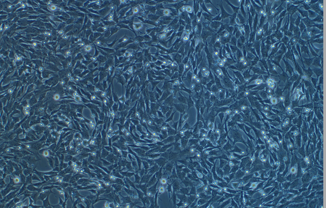 小鼠腎小管上皮細胞TCMK-1(種屬鑒定)