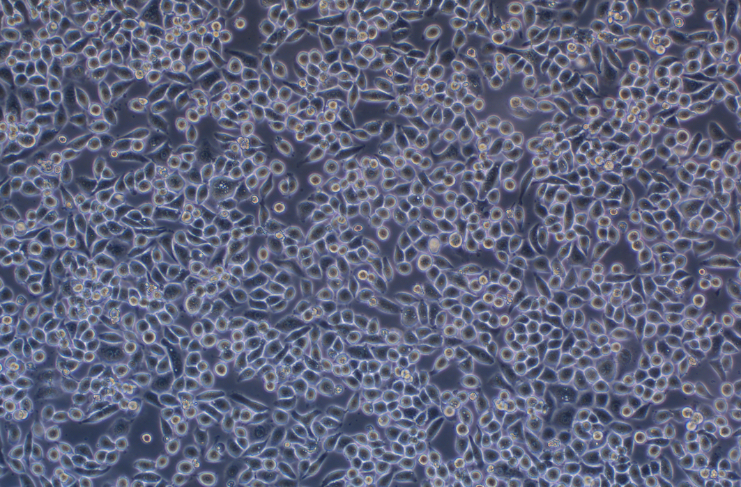 人肺腺癌細胞PC-9(STR鑒定正確)