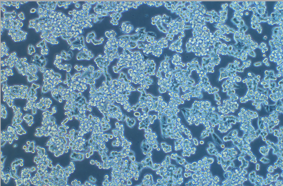 表達HBV病毒的人肝細胞HepG2.2.15 (STR鑒定正確)