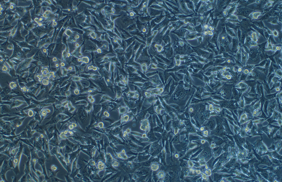 小鼠膠質(zhì)瘤細胞GL261(種屬鑒定)