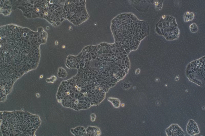 人乳腺管癌細胞EFM-19