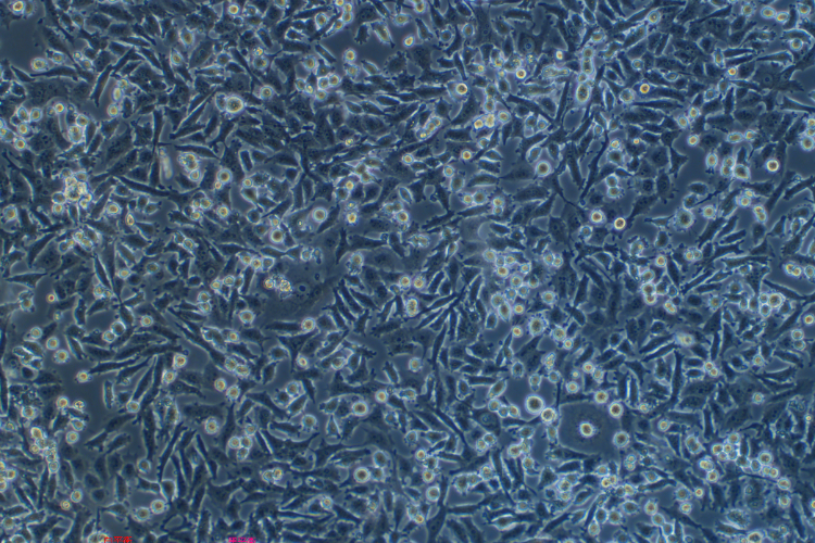 人胰腺癌細(xì)胞PATU8988S (STR鑒定正確)