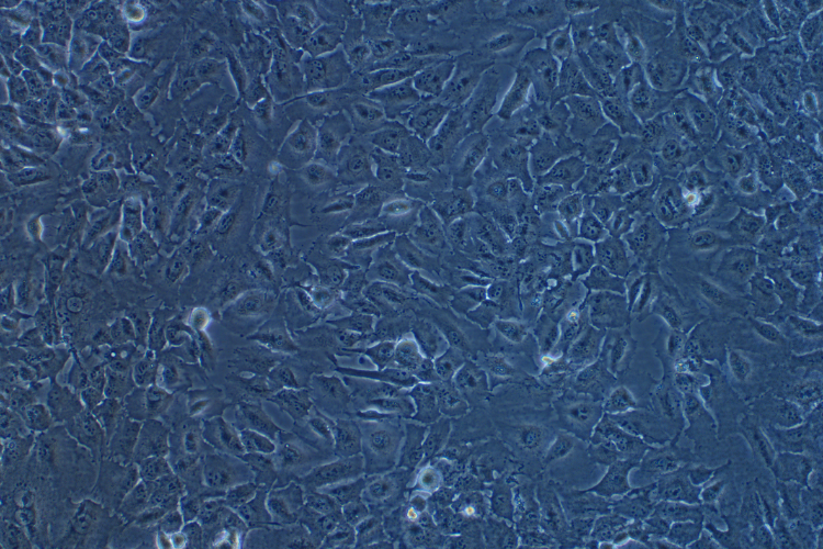 人肺鱗癌細胞SK-MES-1(STR鑒定正確)