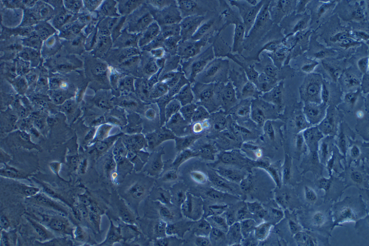 人肺鱗癌細胞SK-MES-1(STR鑒定正確)