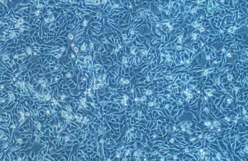 小鼠惡性乳腺癌細胞PY8119(種屬鑒定)