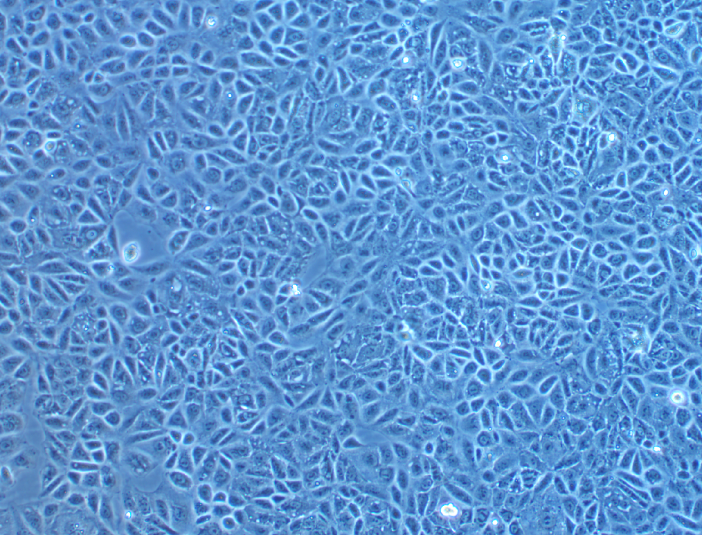 人乳腺癌細胞CAL-51(STR鑒定正確)
