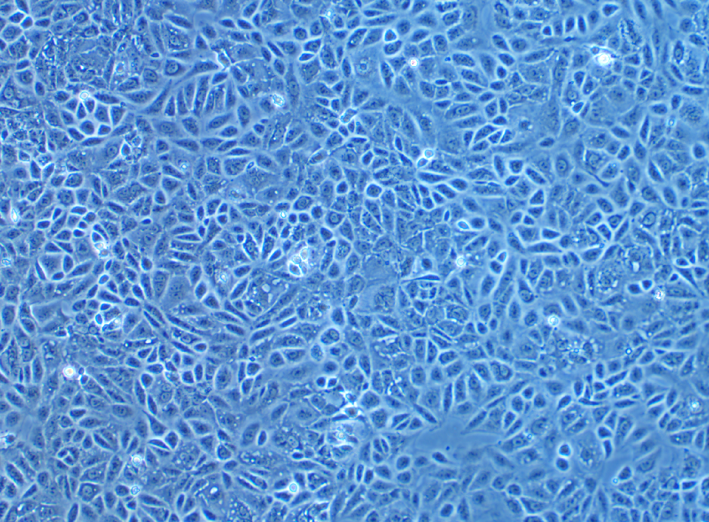 人乳腺癌細胞CAL-51(STR鑒定正確)