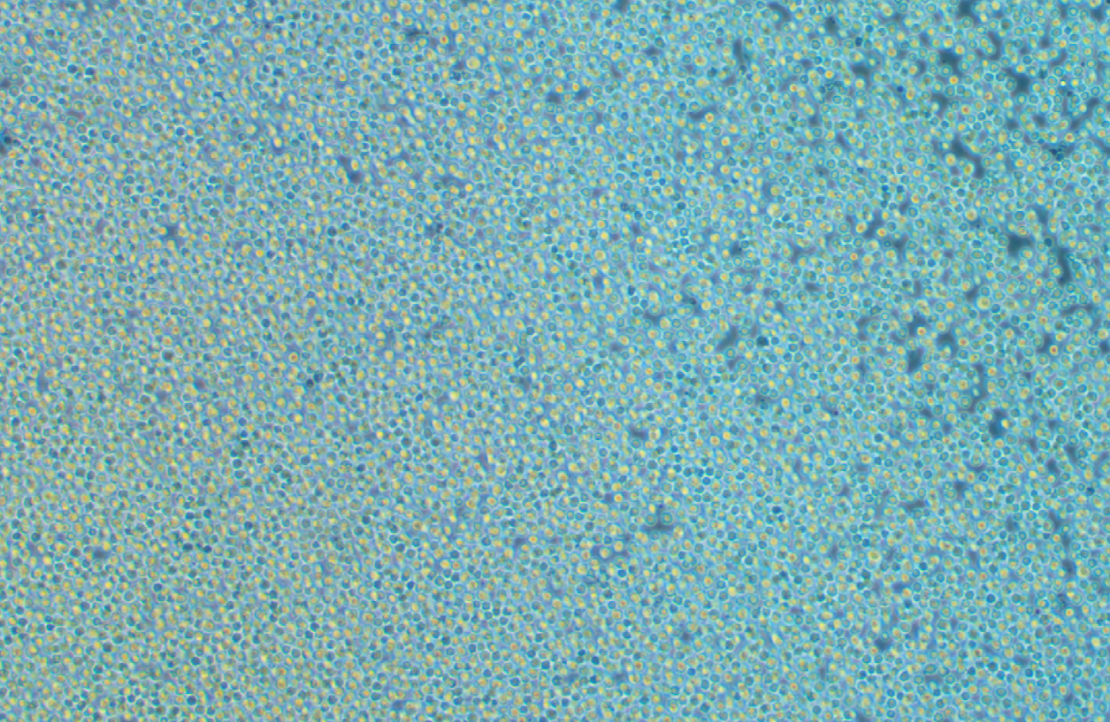 人B細胞淋巴瘤OCI-LY1(STR鑒定正確)