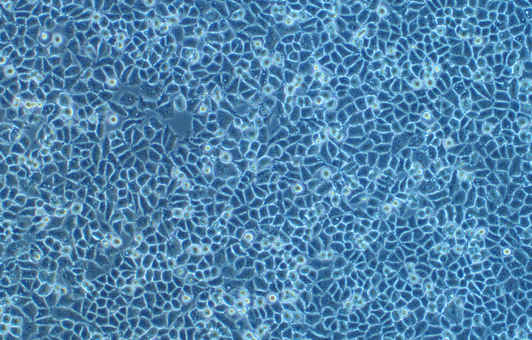 人正常卵巢上皮細胞 IOSE-80(STR鑒定正確)