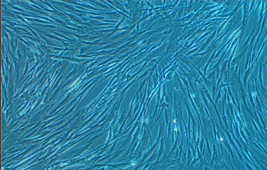 人肺成纖維細胞HFL1(STR鑒定正確)
