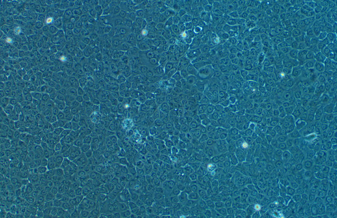 人前列腺增生細(xì)胞BPH-1 ?(STR鑒定正確)