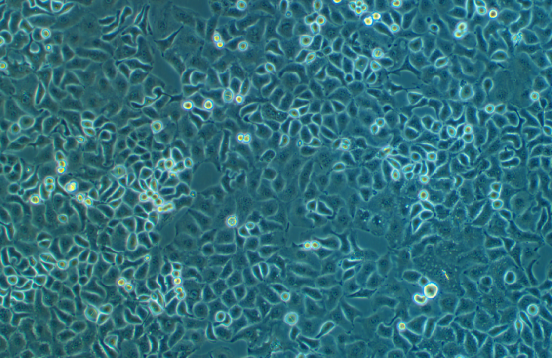 人卵巢癌細胞IGR-OV1?(STR鑒定正確)