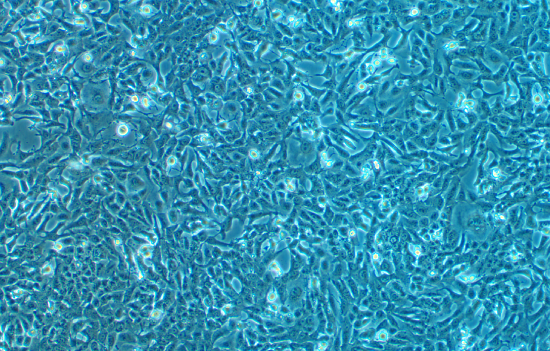 人結直腸癌細胞氟尿嘧啶耐藥株LOVO+5FU(STR鑒定正確)