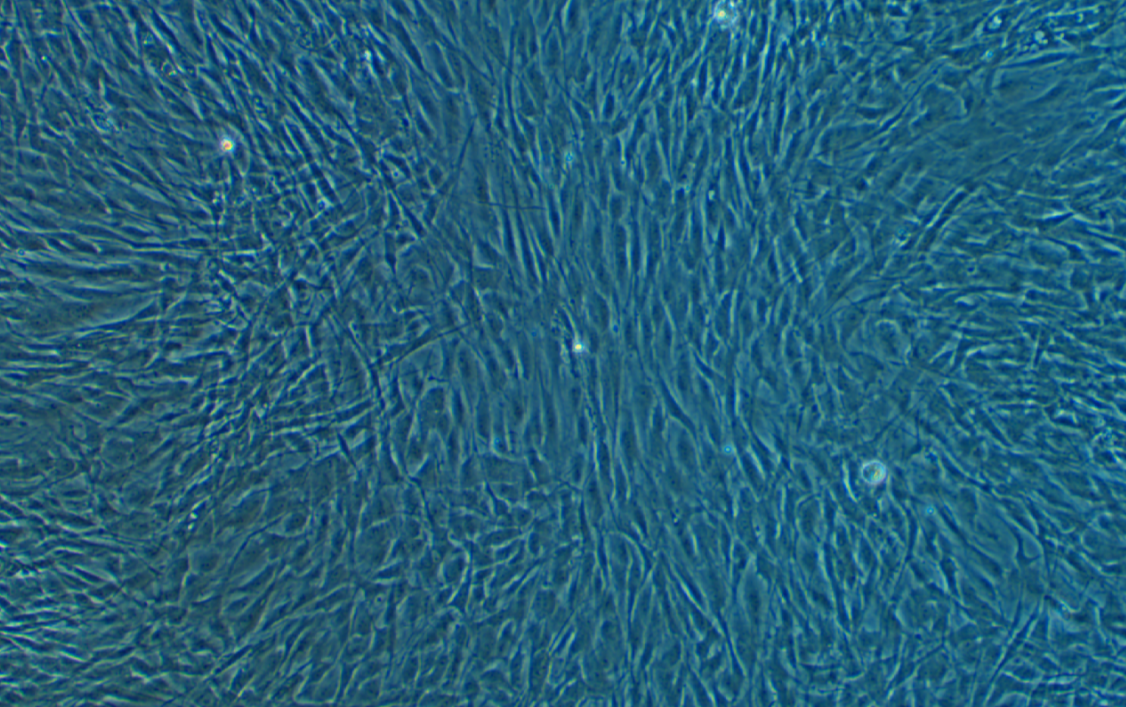 人真皮成纖維細胞