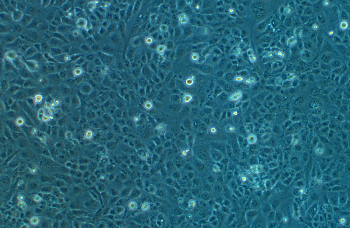 SV-40轉(zhuǎn)化肺成纖維細胞WI38/VA13(STR鑒定正確)