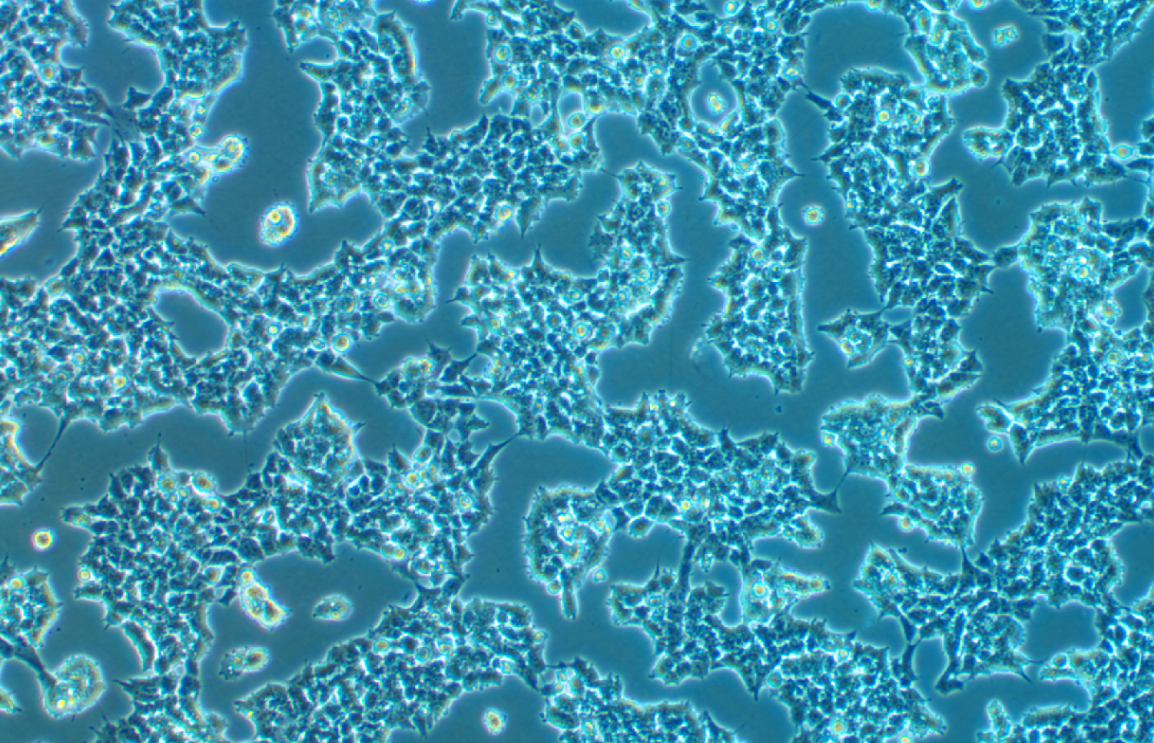 人神經上皮瘤細胞SK-N-MC(STR鑒定正確)
