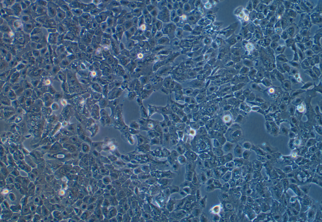 人骶骨脊索瘤細胞MUG-Chor1?(STR鑒定正確)