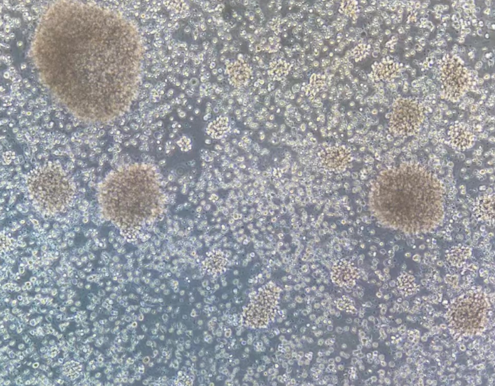 人B淋巴細胞GM12878(STR鑒定正確)