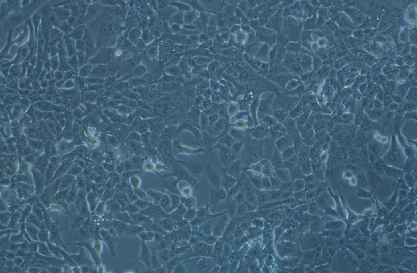 人皮膚鱗癌細胞HSC-5(STR鑒定正確)