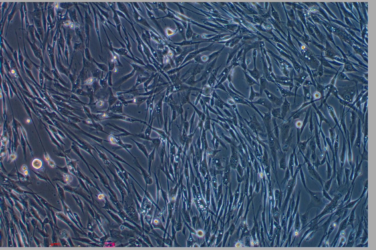 人主動脈平滑肌細胞永生化