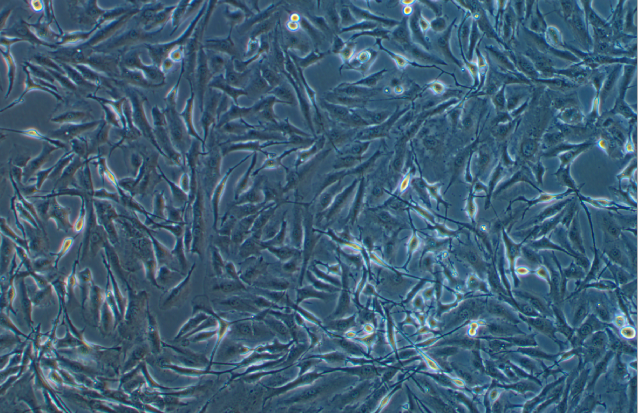 人甲狀腺癌細胞FTC-133 ?(STR鑒定正確)