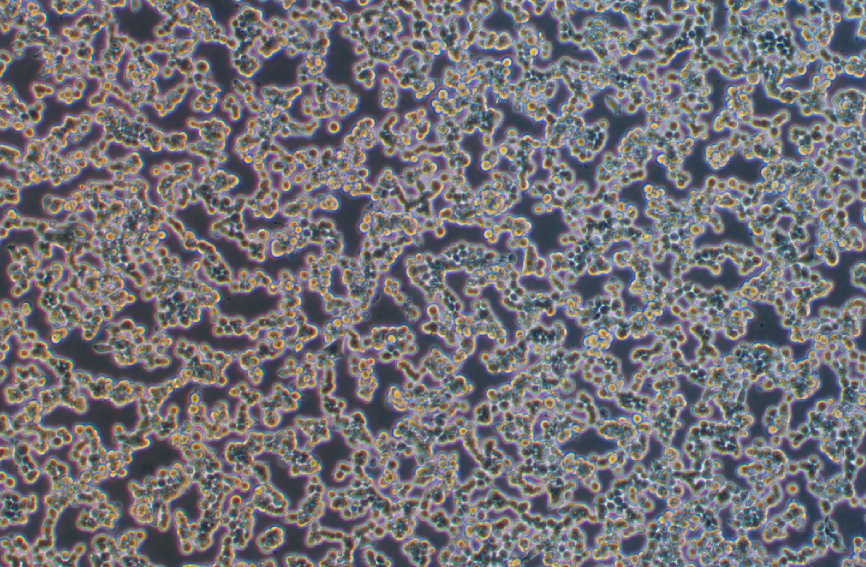 人前列腺癌細(xì)胞VCaP(STR鑒定正確)