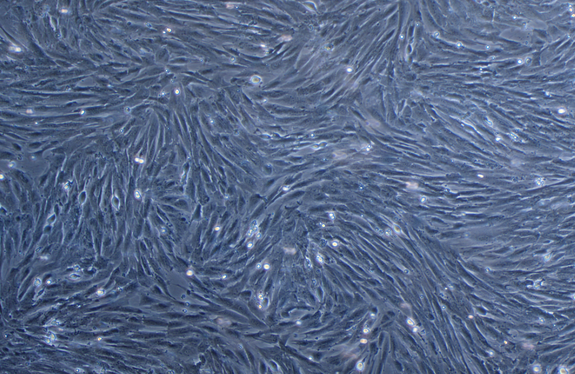 鴨子胚胎成纖維細(xì)胞 Duckembryo(種屬鑒定)