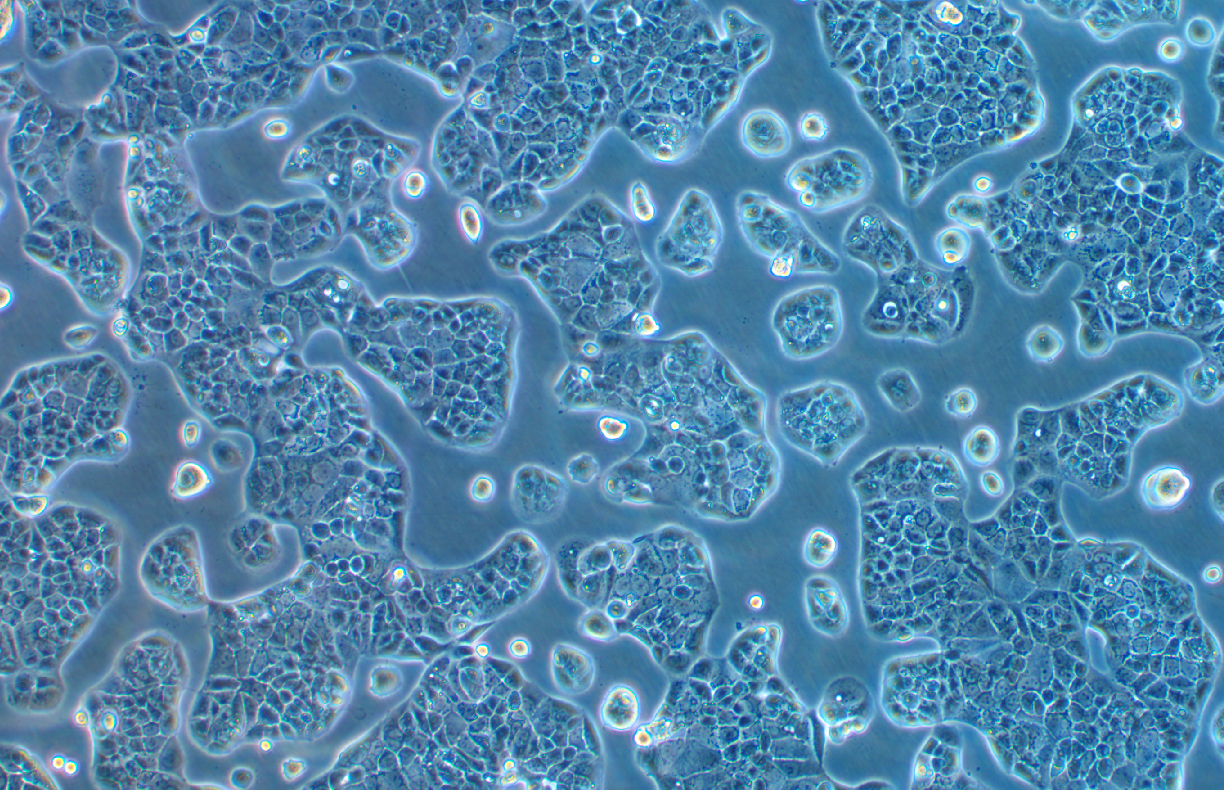 人乳腺管癌細胞EFM-19